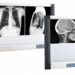 Светодиодные негатоскопы для просмотра рентгенограмм Dixion X-View LED - Медицинское оборудование